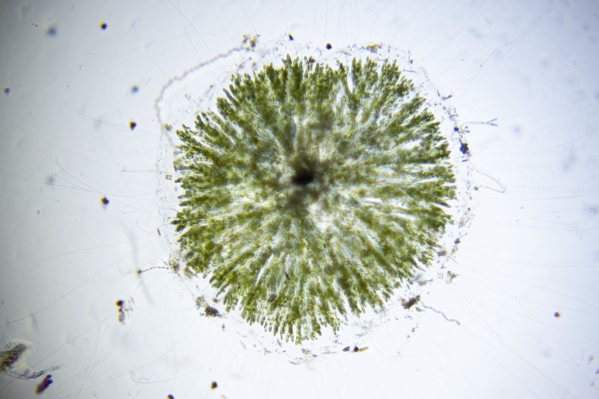 Gloeotrichia | The Microscopic Life of Shetland Lochs